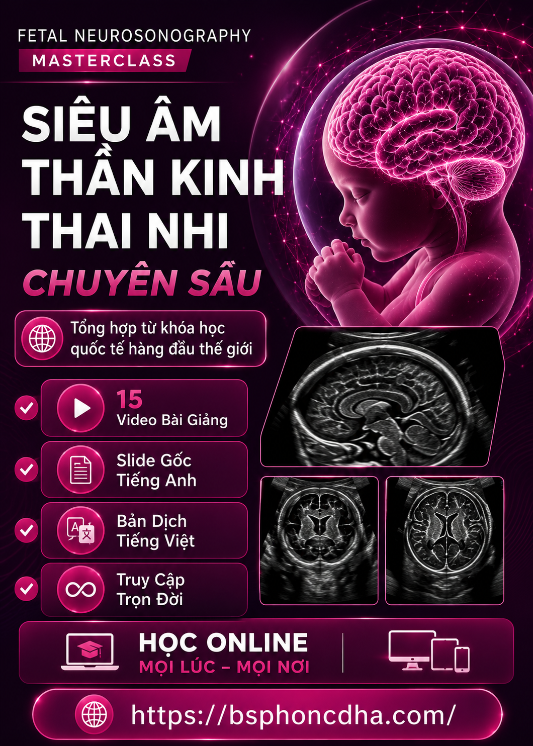 SIÊU ÂM HỆ THẦN KINH TRUNG ƯƠNG THAI NHI 2025