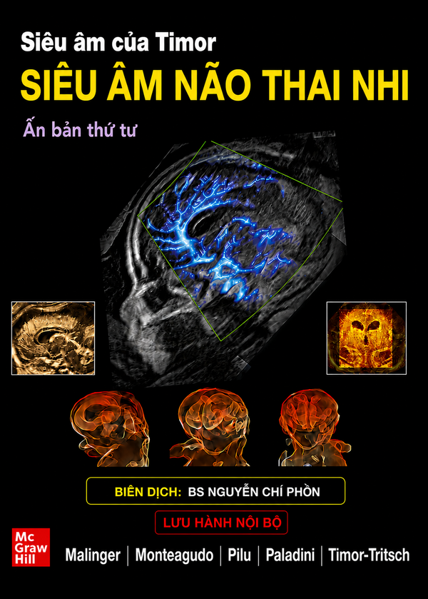 Bìa sách Siêu âm não thai nhi ấn bản thứ tư biên dịch BS Nguyễn Chí Phồn